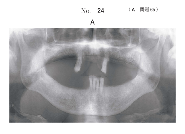 No.24-A